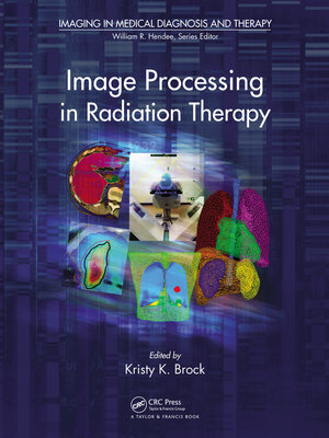 cover image of Image Processing in Radiation Therapy
